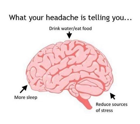 What your headaches are telling you. 1000 Lifehacks, Best Hacks, 1000 Life Hacks, Simple Life Hacks, Diy Life Hacks, Diy Life, The More You Know, Useful Life Hacks, Migraine