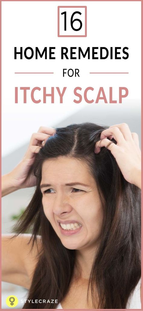 An itchy scalp may be irritating for anyone, especially during the hot summers. Instead of trying a host of market products and professional treatments, use these regular and popular home remedies to eliminate the itchiness from your scalp. Remedies For Itchy Scalp, Itchy Scalp Remedy, Thick Hair Remedies, Dry Itchy Scalp, Flaky Scalp, Hair Roots, Hair Remedies For Growth, Excess Hair, Itchy Scalp