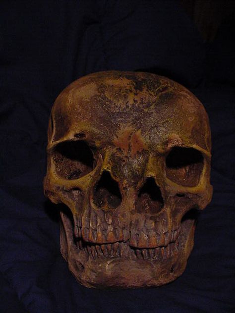 Two Faced skull Real Skull Reference, Pile Of Skulls, Frontal Bone Skull, Real Human Skull, Deformed Skull, Human Oddities, Anthropology, Interesting History, Ancient Aliens