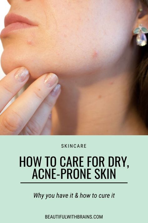 Dry And Acne Prone Skin, Dry Skin Acne Skincare, Skin Care For Dry Acne Prone Skin, Dry Acne Prone Skin Routine, Skin Care Routine For Acne Prone Skin, Dry Skin With Acne, Dry Acne Prone Skin, Skincare Routine For Dry Skin, Routine For Dry Skin