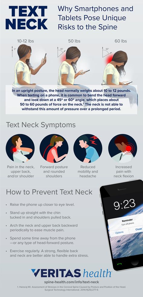 Text Neck Symptoms and Diagnosis Forward Head Posture Exercises, Text Neck, Tech Neck, Forward Head Posture, Spine Health, Neck And Back Pain, Leg Pain, Neck Pain