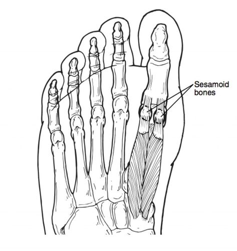 Sesamoid Bone, Yoga Information, Anatomy Lessons, I Love To Run, Body Joints, Joints Pain Relief, Chronic Inflammation, Foot Health, Foot Pain