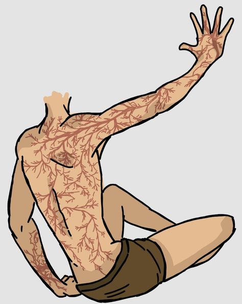 Zombie Acopalypse Oc, Draw Burn Scars Reference, Infected Character Design, Zombie Types Ideas, Burn Victim Character Art, Human Ghost Drawing, Post Apocalypse Character Art, Character Scar Ideas, Missing Arm Character