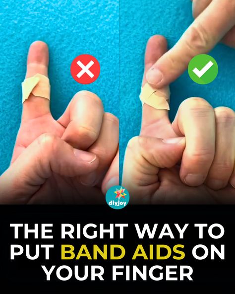 Don't just wrap a bandage on your finger! It will just slip off. Here's the right way to put band-aids on your finger. Finger Bandage, Getting Rid Of Scars, Plaster Hands, Secret Safe, Diy Plaster, Bullet Journal Printables, How To Wrap, Diy Pool, Little Library