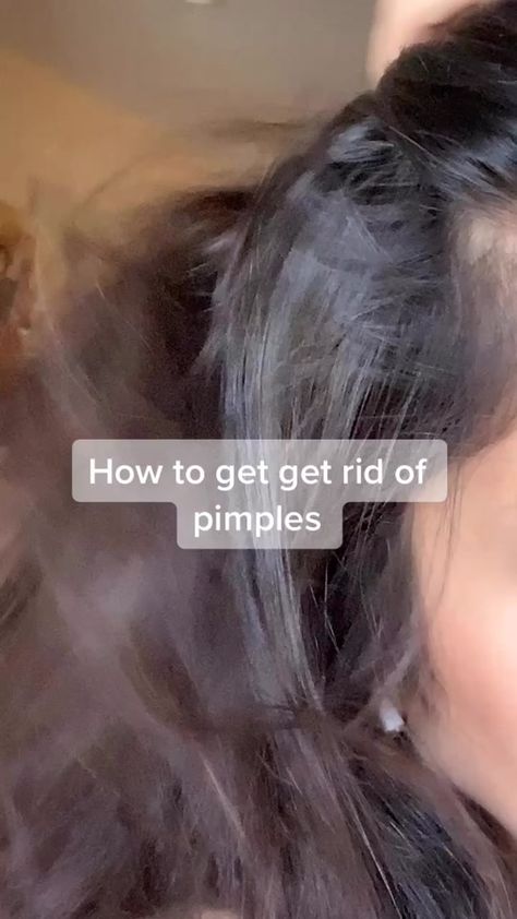 Get Rid Of Pimples, Rid Of Pimples, Haut Routine, Good Skin Tips, How To Get Rid Of Pimples, Beauty Routine Tips, Basic Skin Care Routine, Beauty Tips For Glowing Skin, Clear Skin Tips