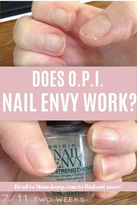 Natural Nails After Acrylic, Best Manicure For Healthy Nails, Opi Nail Envy Before And After, Strengthen Nails After Gel, How To Strengthen Weak Nails, Natural Nail Strengthener Diy, Best Nail Strengthener Products, Natural Nail Health, Strengthen Natural Nails