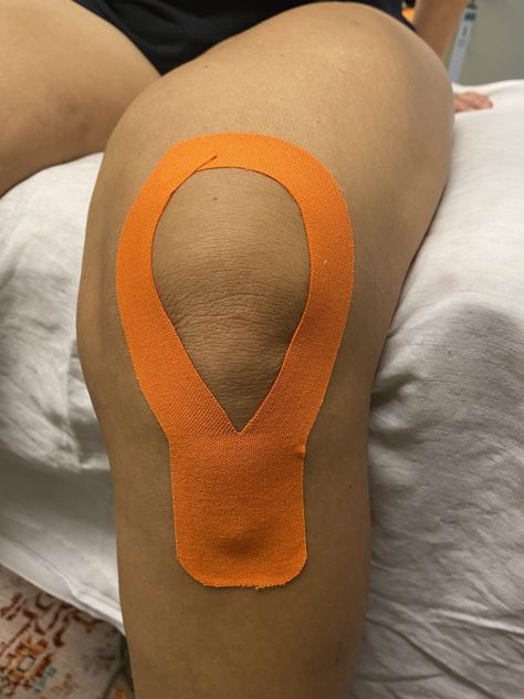 The most common causes of knee pain are related to aging, injury, repeated stress, over-use, over-weight and under-use of the knee. Common knee problems include sprained or strained ligaments, cart… Osgood Schlatter Disease, Knee Problem, Ligament Injury, Tight Hamstrings, Licensed Massage Therapist, Gluteus Medius, Nba Fashion, Kinesiology Taping, Knee Replacement