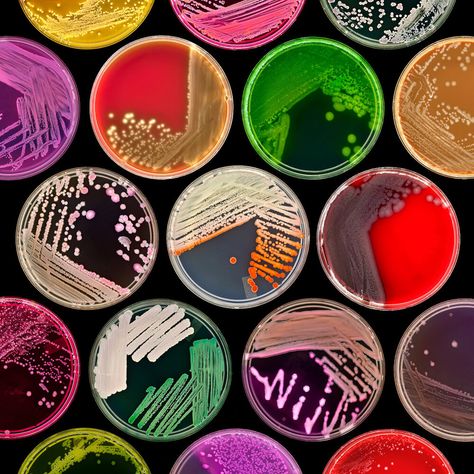 Finalist | Plants & Fungi Microbiology Photography, Microorganisms Microbiology, Microbiology Aesthetic, Microbiology Lab, Science Images, Petri Dishes, Science Stickers, Biology Art, Plant Fungus