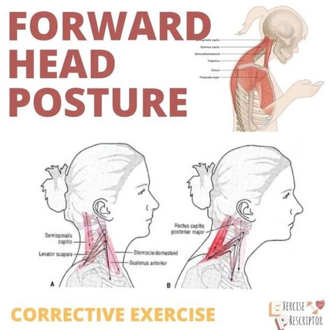 Rotator Cuff Rehab, Neck Posture, Shoulder Rehab, Forward Head Posture, Rotator Cuff, Bad Posture, Posture Correction, Shoulder Pain, U Can