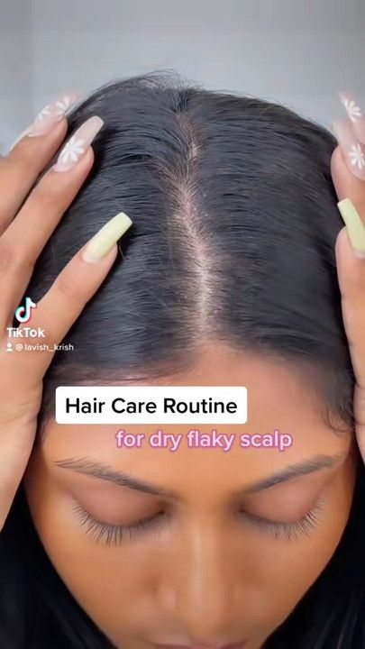 Hair Tips For Growth, Dry Flaky Scalp, Curly Hair Mousse, Oils For Dandruff, Hair Washing Routine, Dry Itchy Scalp, Curl Definition, Flaky Scalp, Hair Care Regimen