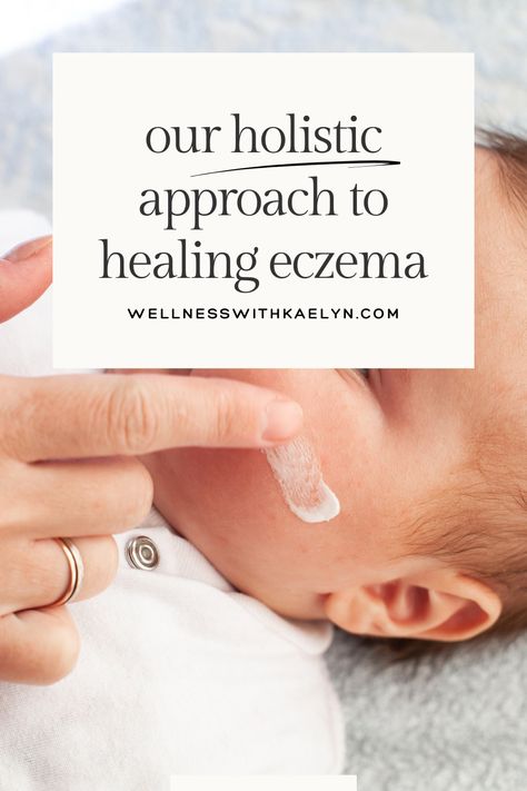 This post shares our holistic approach to healing eczema from the inside out: all natural eczema lotions and creams, eczema friendly diet, and popular supplements for healing eczema from the inside out Inflammatory Recipes, Cystic Acne, Baby Skin Care, Natural Treatments, Holistic Approach, Skin Health, Natural Remedies, Lotion, Inside Out