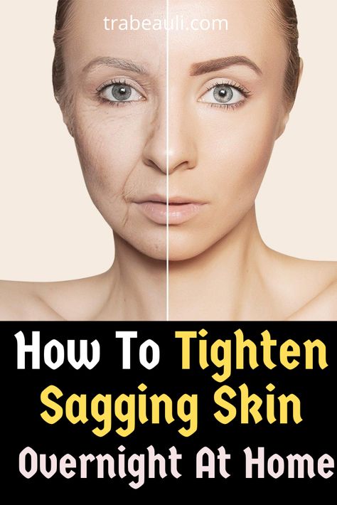 Saggy Face, Wrinkles Remedies Face, Face Pack, Skin Care Wrinkles, Saggy Skin, Glow Skin, Face Wrinkles, Skin Remedies, Sagging Skin