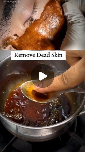 Face Pack For Blackheads, Dead Skin Removal Face, Face Hair Remove Tips, Black Head Remover Diy, Dead Skin On Face, Face Waxing, Diy Facial Hair Removal, Blackheads On Face, Remove Blackheads From Nose