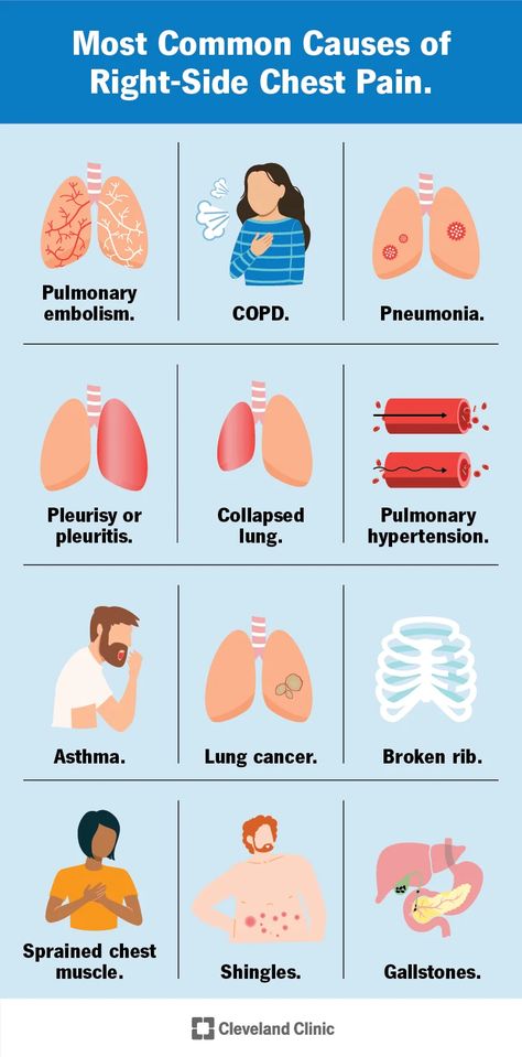 Trapped Gas, Crps Awareness, Chest Discomfort, Severe Asthma, Broken Ribs, Medicine Notes, Chronic Obstructive Pulmonary Disease, Deep Breaths, Side Chest