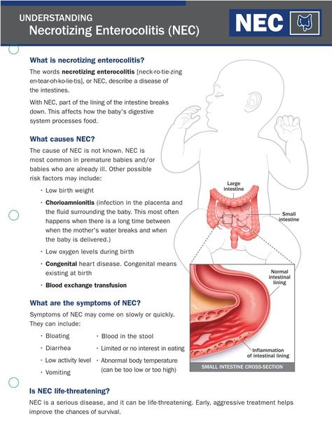 Necrotizing Enterocolitis (NEC) - Associates in Newborn Medicine New Grad Nicu Nurse, Nicu Nurse Notes, Nicu Nursing Education, Nicu Education, Nicu Tips, Midwifery Notes, Nicu Nurse Education, Peds Nursing, Neonatal Nurse Practitioner