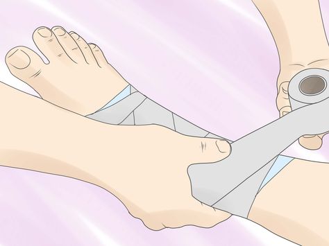 How to Wrap a Sprained Ankle -- via wikiHow.com Ankle Sprain, Swollen Ankles, Kinesio Taping, Foot Injury, How To Wrap, Ankle Injury, Sprained Ankle, Athletic Training, Sports Injury