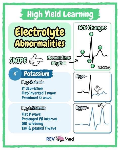 🫀Waiting for you to diagnose the last slide so swipe and comment below! And some notes for you here ⤵️ Believe me… the more you look at this stuff & practice identifying ECGs… the better you become at diagnosing. Don’t fear saying something wrong - we have a ton of medical professionals here on IG… and they are willing to help! Don’t forget to come back for more here 👉🏼 @rev.med ✅ Overview Normal cardiac action potential may be altered by electrolyte imbalance, this is because of changes ... Nursing Basics, Ace Inhibitors, Electrolyte Imbalance, Action Potential, Nurse Skills, Pr Interval, Nursing School Essential, Nurse Study Notes, Nursing School Survival