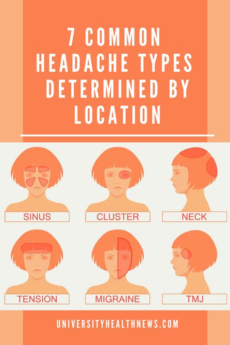 Headache is the most common form of pain. Although there are over 150 types of headache, only a few types are common. The location of your headache can help you know the type. « Previous Headache Location Meaning, Headache Meaning, Headache Location, Tension Migraine, Hangover Headache, Headache Types, Health And Fitness Magazine, Healthy Diet Tips, Tension Headache