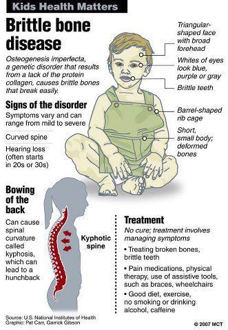 Brittle Bone Disease Osteogenesis Imperfecta, Collagen Products, Physical Therapist Assistant, Bone Diseases, Natural Collagen, Musculoskeletal System, Genetic Disorders, Nursing Notes, Pediatric Nursing