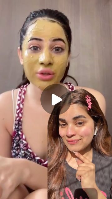 Acne Removal Face Mask, Anti Tanning Remedies, Diy Tan Removal Mask, Multani Mitti Face Pack For Acne, Detan Face Mask, Face Mask For Tan Removal, Tan Face Mask, Remove Tan From Face, Multani Mitti Face Pack