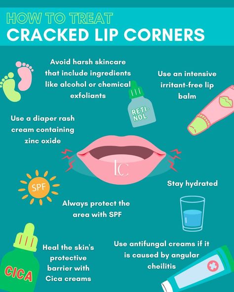 How to get rid of dry cracked lip corners fast How To Get Rid Of Dry Lips, Cracked Lips Remedy, Cracked Lip Corners, Lip Pimple, Angular Cheilitis, Upper Lip Hair, Antifungal Cream, Healthier Habits, Spf Lip Balm