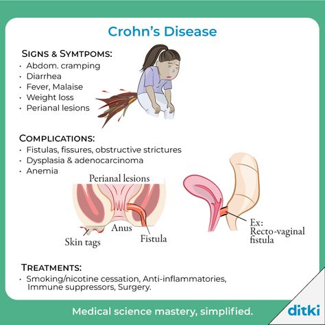 What are some extraintestinal presentations of CD?  Learn more: https://ditki.com/course/gastrointestinal-system/pathology/inflammatory-bowel-disease/1715/inflammatory-bowel-disease  #ditki #usmle #meded #medschool #medstudent #highered #crohns #GIpathology #pathology #nursing #pance #physicianassistant #osteopath #allopath #medicine #science #healthscience #nurse #premed #mcat #mbbs Intestinal Inflammation, Crohns Diet, Nurse Study, Autoimmune Disorders, Inflammatory Bowel, Gastrointestinal System, Nurse Study Notes, Gastrointestinal Disorders, Pre Med