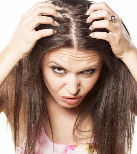 3507---Greasy-Scalp-and-Brittle-Ends---How-to-Treat Very Short Hair, Apply Coconut Oil, Natural Shampoo And Conditioner, Hair Academy, Natural Shampoo, Dry Scalp, Dandruff, Free Hair, Hair A