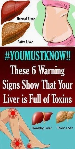 6 CLEAR WARNING SIGNS YOUR LIVER IS FULL OF TOXINS AND MAKING YOU FAT (HOW TO STOP IT) Natural Add Remedies, Skin Breaking Out, Women Health, Excessive Sweating, Liver Detox, Healthy Liver, Cardio Gym, Liver Health, Diet Keto