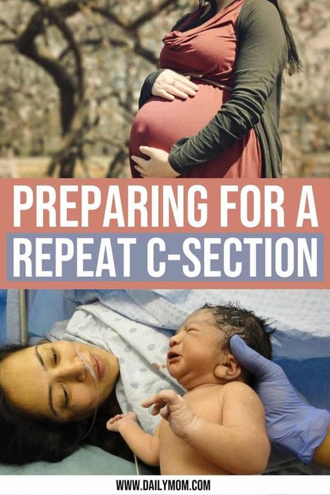 Maternity Leave Quotes, Prepare For C Section, Repeat C Section, C Section Belly, Emergency C Section, C Section Scars, C Section Recovery, Cesarean Section, Mommy Moments