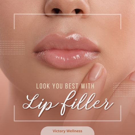 Full lips are a sign of youth and beauty, especially in the culture of today. Do you have thinner lips? Want an extra oomph? Lip Filler from Victory Wellness is the answer. We use the best pharmaceutical grade fillers to give you long lasting and beautiful full lips. Contact us in Naples or Cincinnati. Ask about our NEW PATIENT discount. Victory Cincinnati www.victorywellness.com  513-640-0998 Victory Naples www.victorywellnessnaples.com 239-294-8879 #lipfiller #lips #aesthetics #botox # Lip Filler Pouty Lips, Lip Filler Myths, 0.55ml Lip Filler, .5ml Vs 1ml Lip Filler, Bridal Facial, .5ml Lip Filler, Dermal Fillers Lips, Eye Shadow Application, Anti Wrinkle Injections