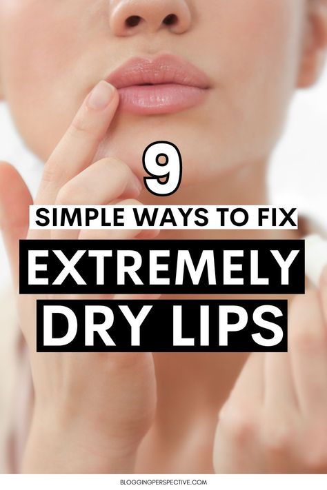 Say goodbye to dry lips with our proven dry lips remedies. Learn how to maintain soft, hydrated lips with our easy lip care tips. Perfect your pout and keep chapped lips at bay by visiting our blog today! How To Have Moisturized Lips, How To Get Rid Of Dry Lips Fast, What To Do For Dry Lips, Remedy For Dry Lips, How To Make Lips Soft, How To Keep Lips Hydrated, How To Fix Dry Lips, Chapped Lips Remedy Severe, Lips Care Tips