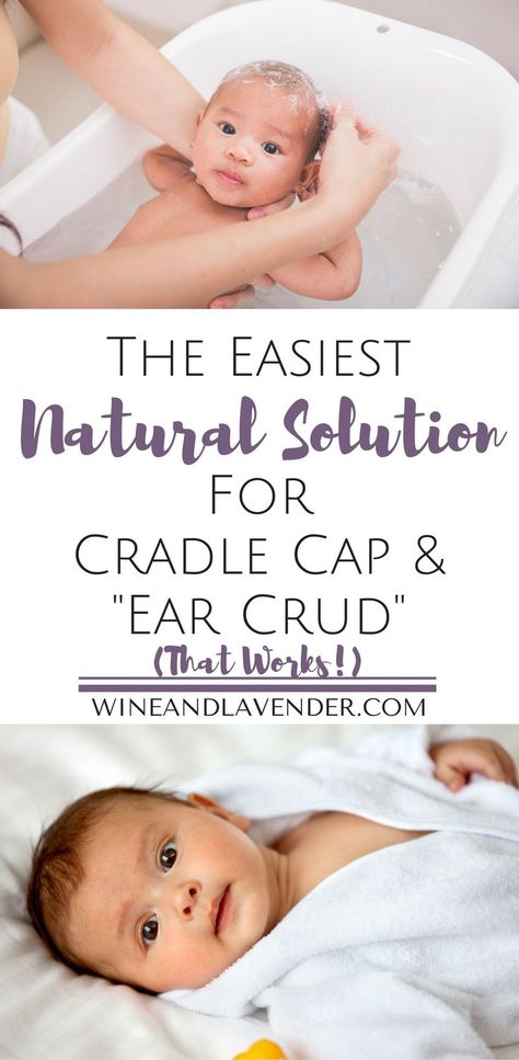 Natural Remedies For Cradle Cap, How To Get Rid Of Cradle Cap, Cradle Cap Remedies, Baby Cradle Cap, Cradle Cap, Diaper Bag Essentials, Baby Cradle, Newborn Hacks, Natural Pregnancy