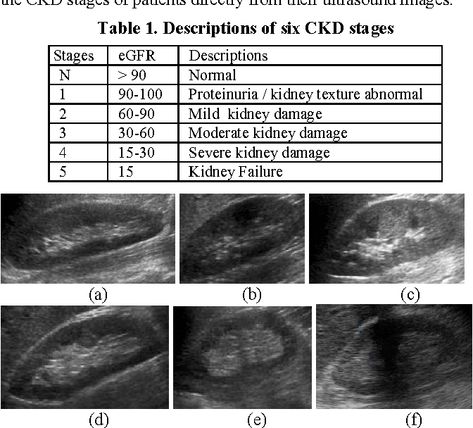 Table 1 from Stage Classification in Chronic Kidney Disease by Ultrasound Image - Semantic Scholar Abdomen Ultrasound Protocol, Ultrasound Anatomy, Abdomen Ultrasound, Diagnostic Medical Sonography Student, Abdominal Ultrasound, Ultrasound School, Obstetric Ultrasound, Ultra Sound, Sonography Student