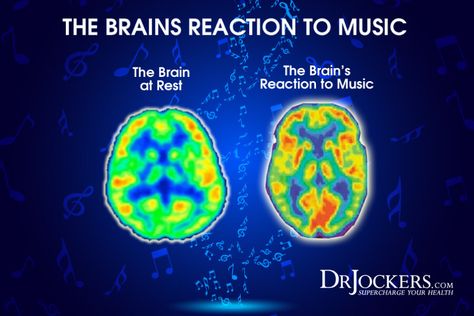 3 Ways Music Therapy Improves Brain Function - DrJockers.com Listening To Music Reaction Pic, Music Reaction Pic, Music And The Brain, Soren Kierkegaard, Brain Images, Brain Facts, Language Centers, Cognitive Science, Improve Brain Function