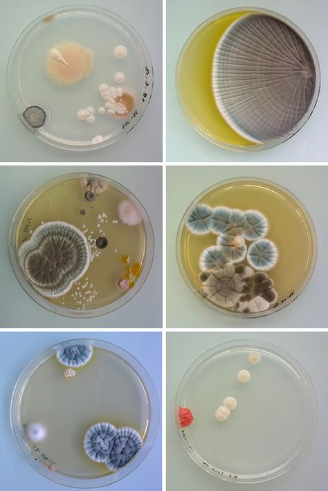 starting point Skin Anatomy, Foto Macro, Microscopic Photography, Growth And Decay, Petri Dishes, Biology Art, Bio Art, Petri Dish, Gcse Art