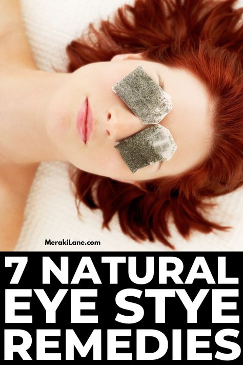 7 Natural Eye Stye Remedies to Reduce Pain and Swelling How To Treat A Stye Eye, Sty Eye Remedies How To Get Rid, Natural Remedies For Stye Eye, Essential Oils For Stye On Eyelid, How To Heal A Stye Fast, Stye Remedies Fast, Swollen Eyelids Remedy, Stye Remedies, Stye Remedy