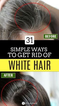 Get Rid Of White Hair, Remedy For White Hair, Grey Hair Remedies, Ayurvedic Hair Oil, Hair Pack, Lost Hair, Hair Remedies, Hair Problems, Hair Maintenance