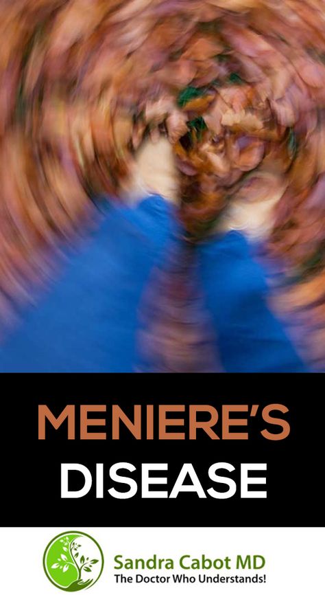 Meniere’s disease is a condition characterized by recurrent episodes of vertigo (dizzy spells in which the patient feels like the world is spinning around them) associated with ringing in the ears (tinnitus) and deafness. Nausea, vomiting, sweating and faintness often accompany the vertigo attacks. Dizzy Spells, Neck Pain Relief, Health Guide, When You Sleep, Health Matters, Neck Pain, Natural Healing, Pain Relief, Disease