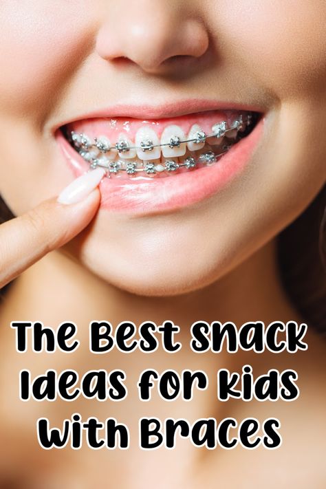 snacks for kids with braces Soft Foods After Getting Braces, Easy Meals For Braces, School Lunch Ideas For Kids With Braces, Good Food To Eat With Braces, Good Foods To Eat With Braces, Best Food To Eat With Braces, What To Eat After Braces, Brace Friendly Recipes, Healthy Braces Friendly Snacks