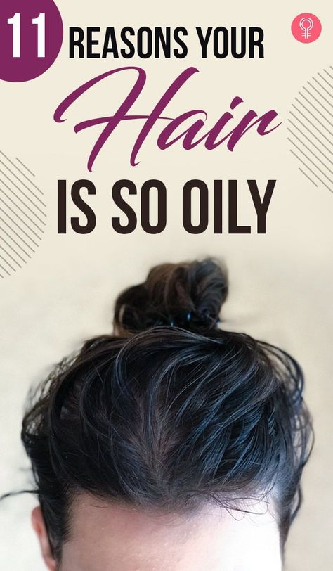 11 Reasons Your Hair Is So Oily: If you have an oily scalp, you’re not alone. We know that excess oil buildup can make your hair greasy, brittle, and grimy, which provides an excellent habitat for fungus to expand. In addition, it produces dandruff, a foul scalp, and makes your skin oily and acne-prone. To prevent this, you can tie your hair in a ponytail. How To Maintain Oily Hair, How To Help Oily Hair, How To Make Hair Less Oily, Oils For Oily Hair, Oily Scalp Remedy, Greasy Hair Remedies, Prevent Oily Hair, Oily Hair Remedies, Hair Care Recipes