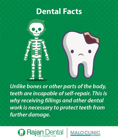 Fun Dental Facts, Dental Sayings, Dental Campaign, Dental Quotes, Dental Posts, Dental Posters, Dental Health Month, Kids Dentist, Dental Work