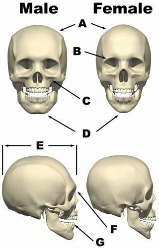 differences female male skull - Anatomy ... Female Skeleton, Baby Gender Prediction, Skull Anatomy, Head Anatomy, Skull Reference, Skeleton Anatomy, Face Anatomy, Human Body Anatomy, Human Anatomy Drawing