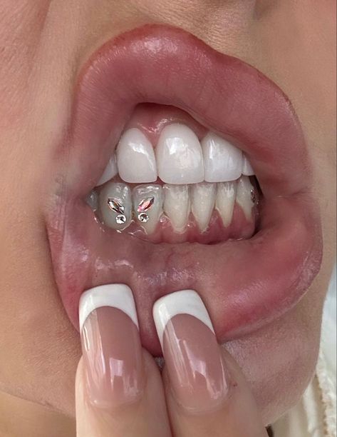 Teeth Gems Butterfly, Bottom Teeth Gems, Tooth Gems Butterfly, Bottom Tooth Gem, Tooth Gems Bottom Teeth, Butterfly Tooth Gem, Teeth Piercing, Teeth Jewels, Grillz Silver