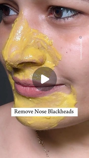 𝑩𝒆𝒂𝒖𝒕𝒊𝒇𝒖𝒍 𝒀𝒐𝒖 𝑻𝒊𝒑𝒔 on Instagram: "Nose & Chin blackhead, Whitehead removal, easy home-made remedy. Try this weekly, two time and you get best result get rid of blackhead Whitehead dead skin and get glass like shiny, healthy skin from your nose and chin areas, especially also you can ask me if you have any query or any doubt in the comment section Love to answer.❤️. . . . . . Follow for more. #skincare #beauty #beautytips #reels #blackheads" Home Remedy For Blackheads On Nose, Home Remedies For Blackheads, Nose Blackheads Removal At Home, How To Remove Blackheads At Home, How To Remove Blackheads From Nose, Blackheads Remedy, Remove Blackheads From Nose Homemade, Home Remedy For Blackheads, How To Get Rid Of Blackheads