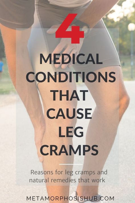 Reasons for Leg Cramps- woman holding her massaging her calf Leg Pain Relief Remedies, Severe Leg Cramps, Leg Cramps Causes, Nerve Pain Remedies, Leg Cramps At Night, Calf Cramps, Pain Relief Remedies, Cramps Relief, Leg Cramps