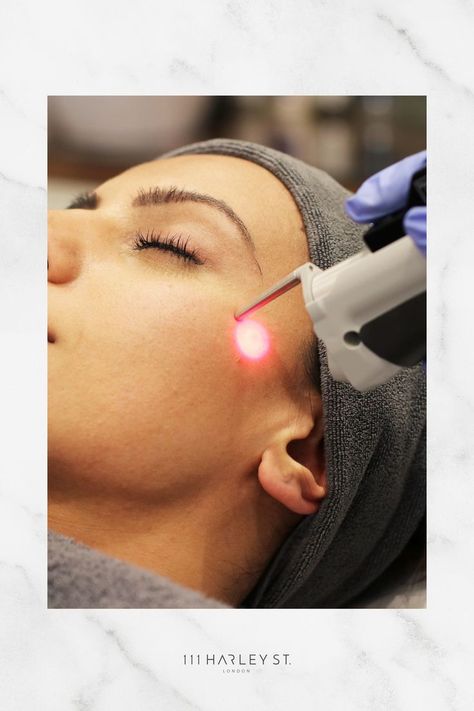 Esthetics Pics, Cynosure Laser, Face Laser, Laser Facial, Yag Laser, Nd Yag Laser, Laser Skin, Instagram Ideas Post, Laser Therapy