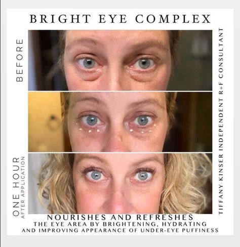 Bright Eye Complex Multifunction Eye Cream, Cream For Dark Circles, Under Eye Cream, Hydrating Eye Cream, Dark Eye Circles, Eye Cream For Dark Circles, Upper Eyelid, Under Eye Puffiness, Dark Circles Under Eyes