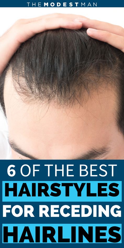 Haïr Style For Men, Men’s Hair Cuts For Receding Hairline, Short Hair Style For Men, Best Haircut For Receding Hairline Men, Men Receding Hairline Hairstyles, Men’s Short Hairstyles Receding Hairline, Hairstyles For Men With Receding Hair, Men Haircut Thinning Hair, Haircut For Thinning Hair Mens