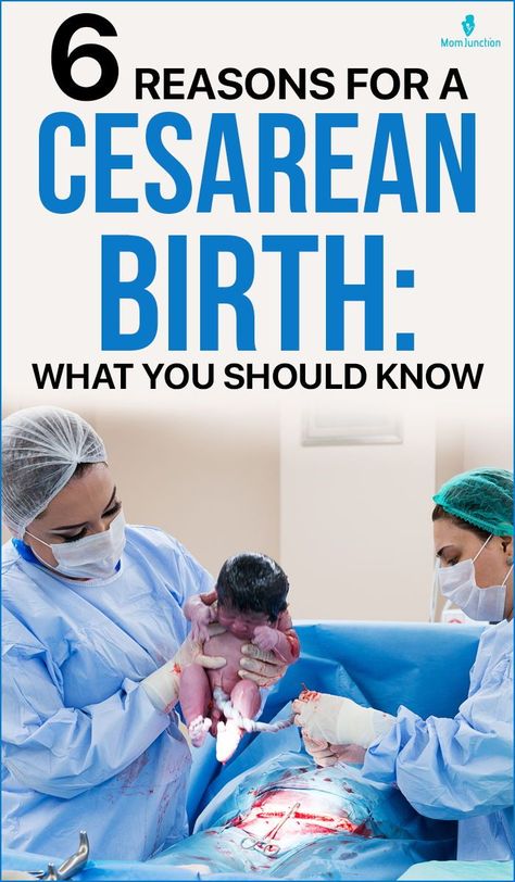 Cesarean Delivery, Emergency C Section, Doula Business, Cesarean Section, Abdominal Surgery, Toxic Parents, Pregnancy Guide, Take A Bath, Taking A Bath