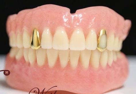 False Teeth, Fake Teeth, Dental Lab, Dentures, Lab, Gold, Quick Saves